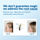 Hair Growth Serum Roll on 25 ml